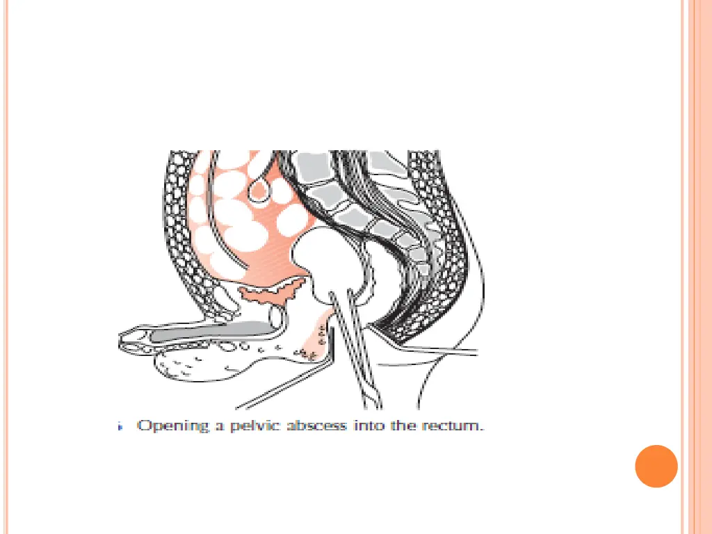 slide8