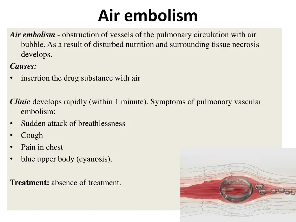 air embolism