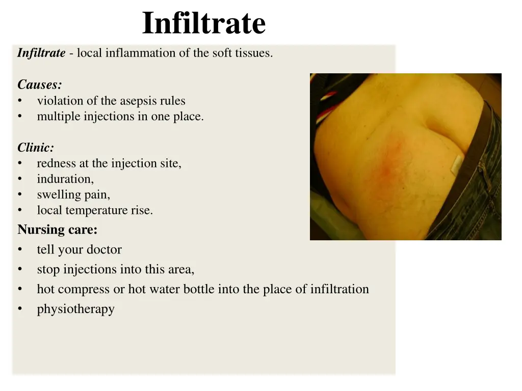 infiltrate