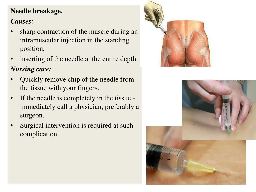 needle breakage causes sharp contraction
