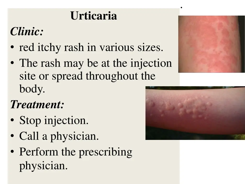 slide13