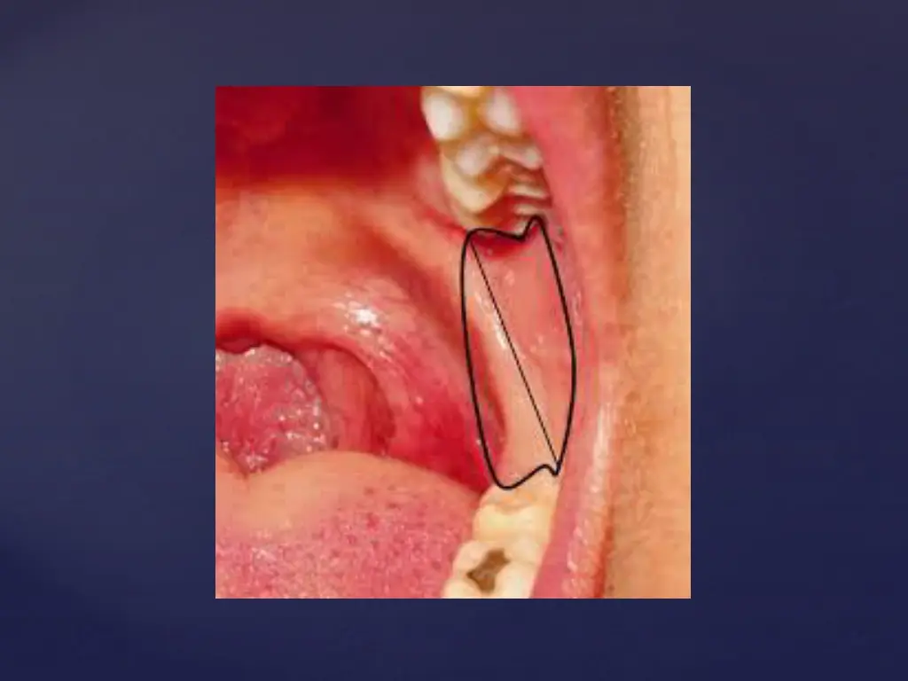 slide10