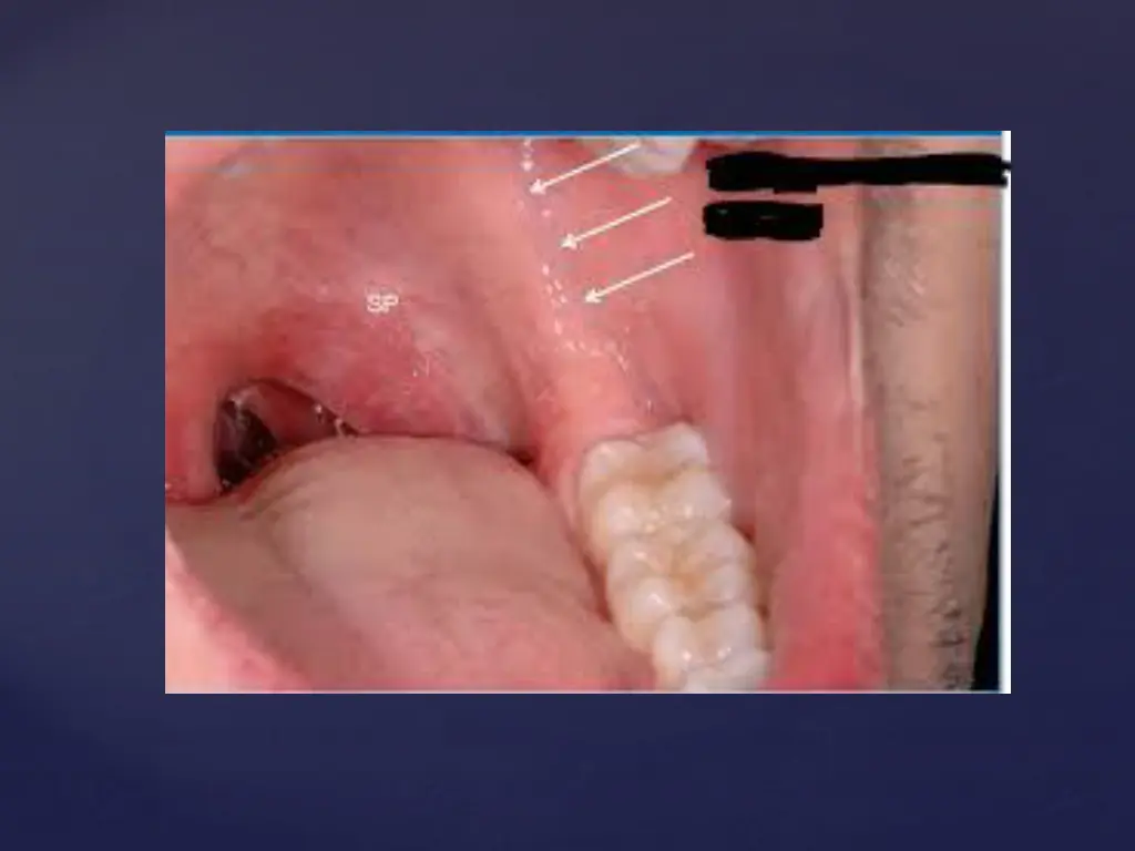 slide11