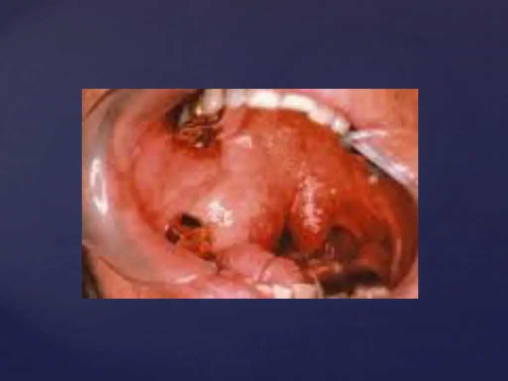 slide12