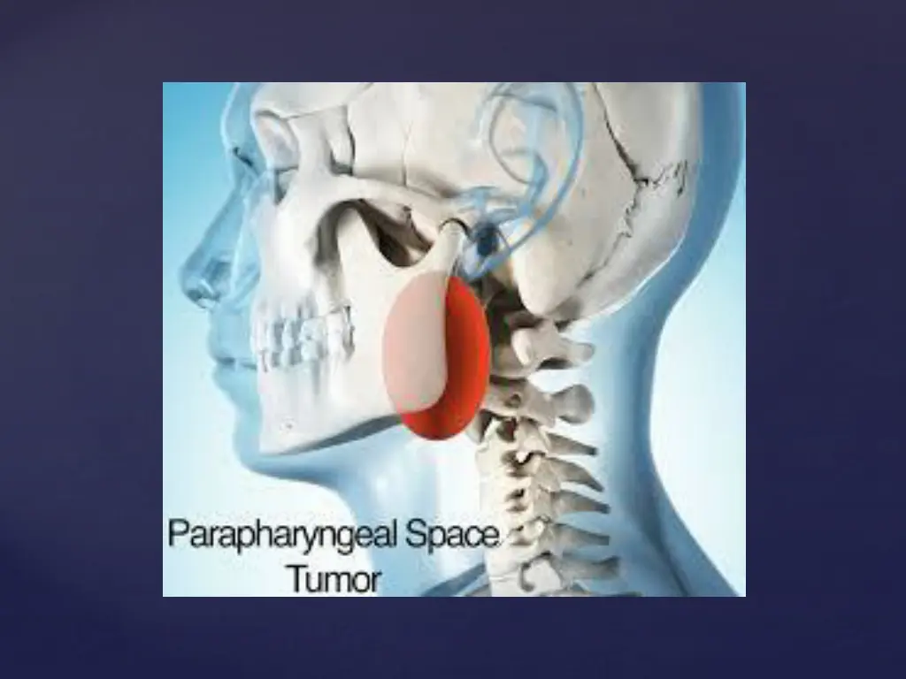 slide14