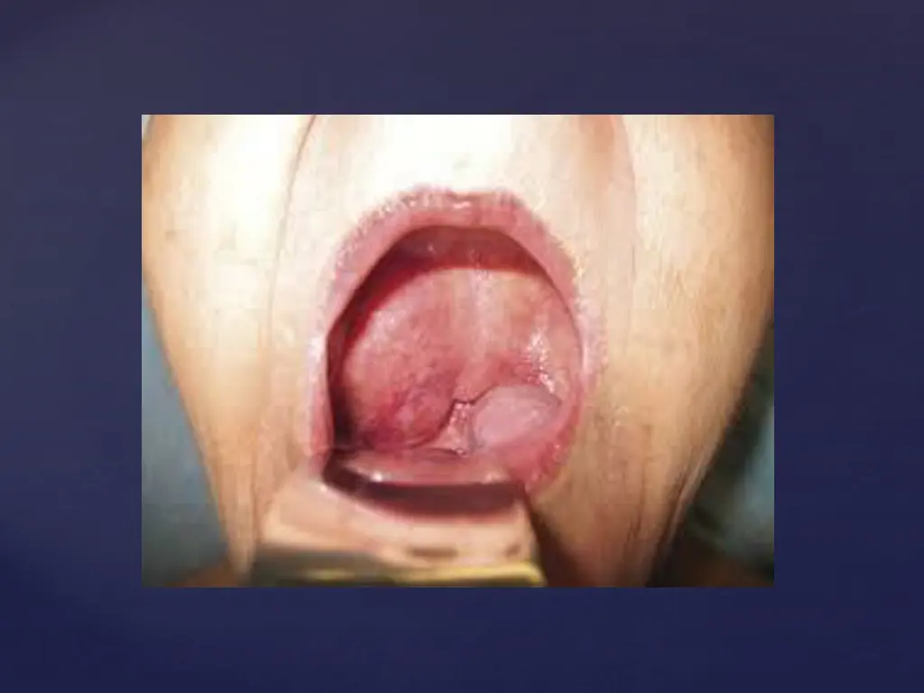 slide15