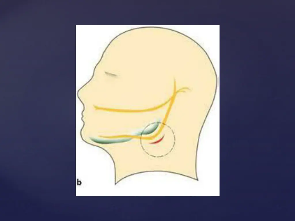 slide19