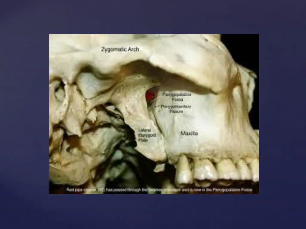 slide30