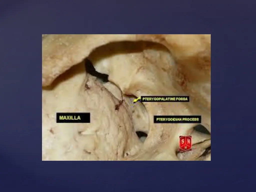 slide32