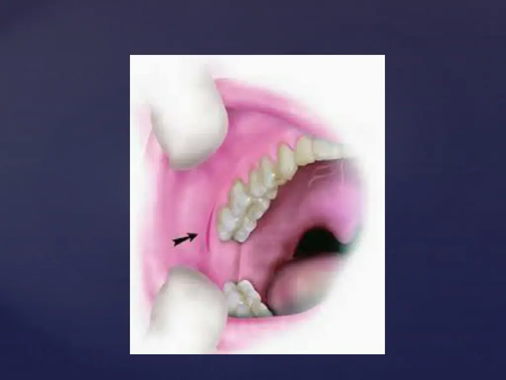 slide37