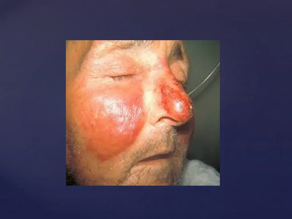 slide47