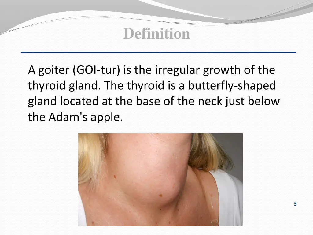 definition