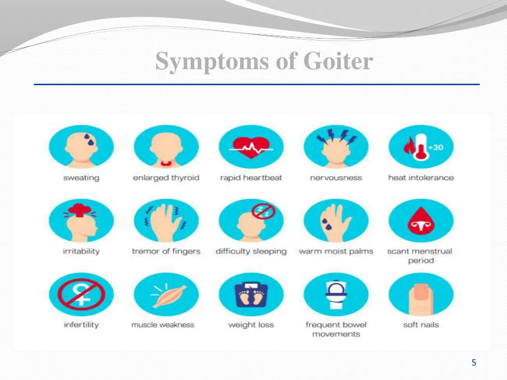 symptoms of goiter