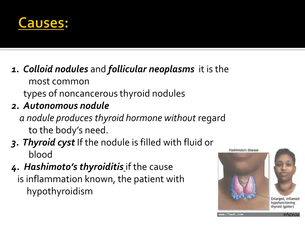 1 colloid nodules and follicular neoplasms