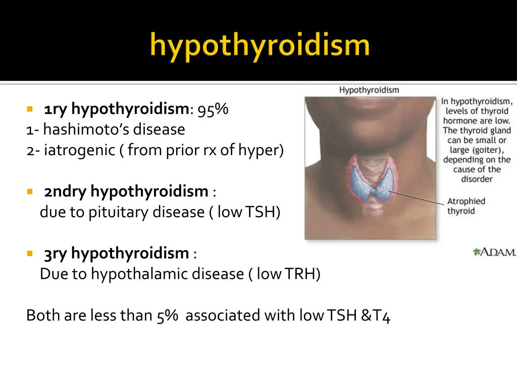 1ry hypothyroidism 95 1 hashimoto s disease