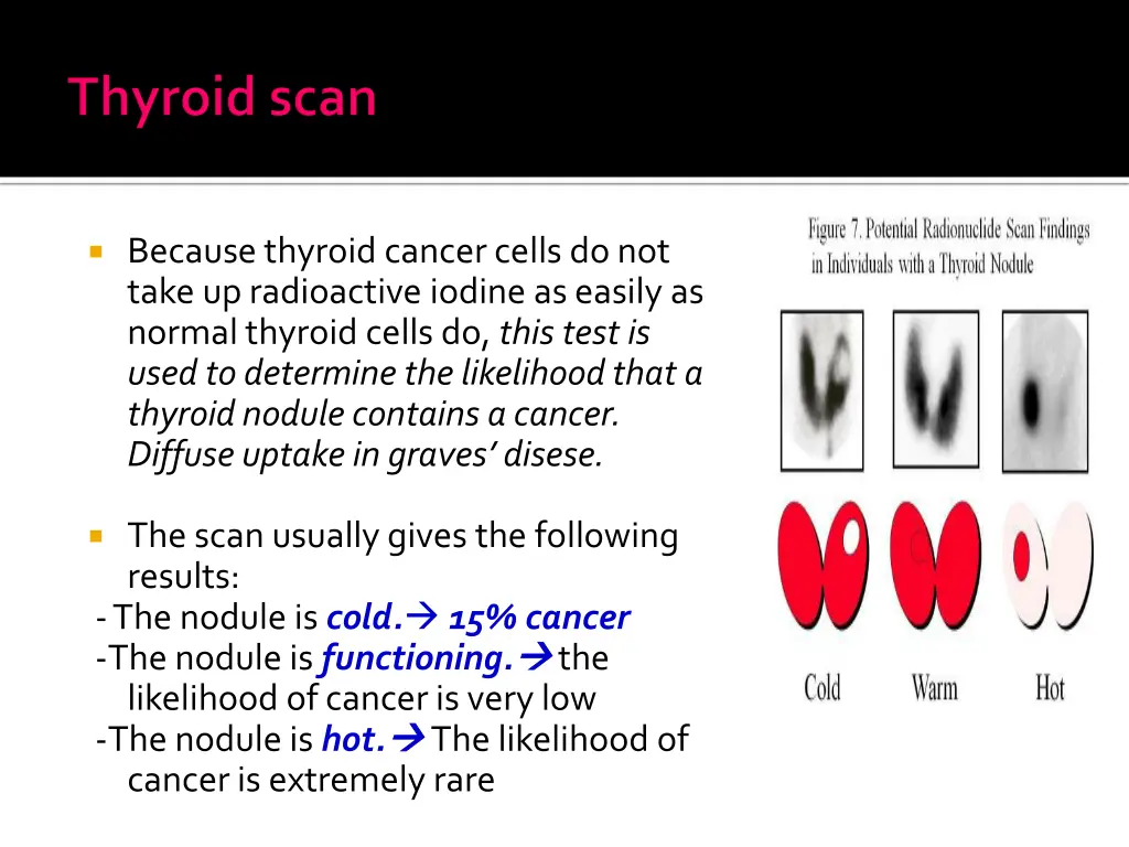 because thyroid cancer cells do not take