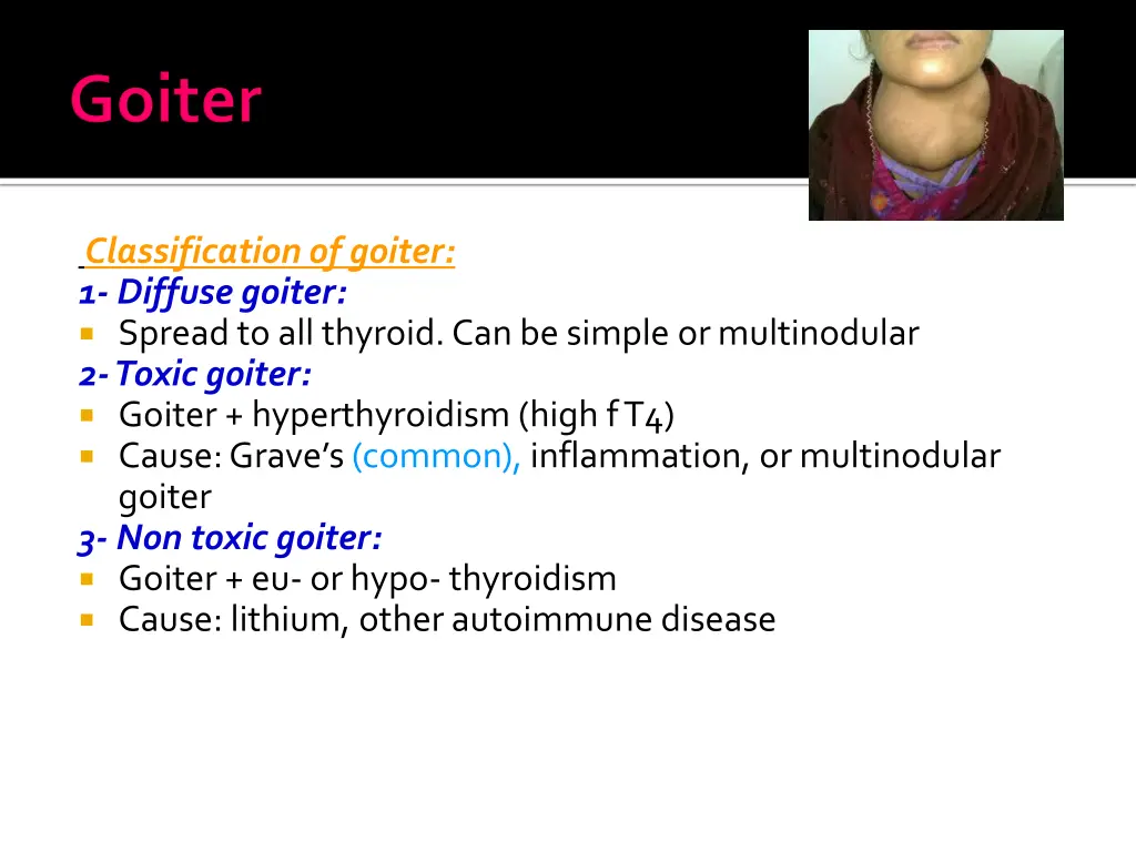 classification of goiter 1 diffuse goiter spread