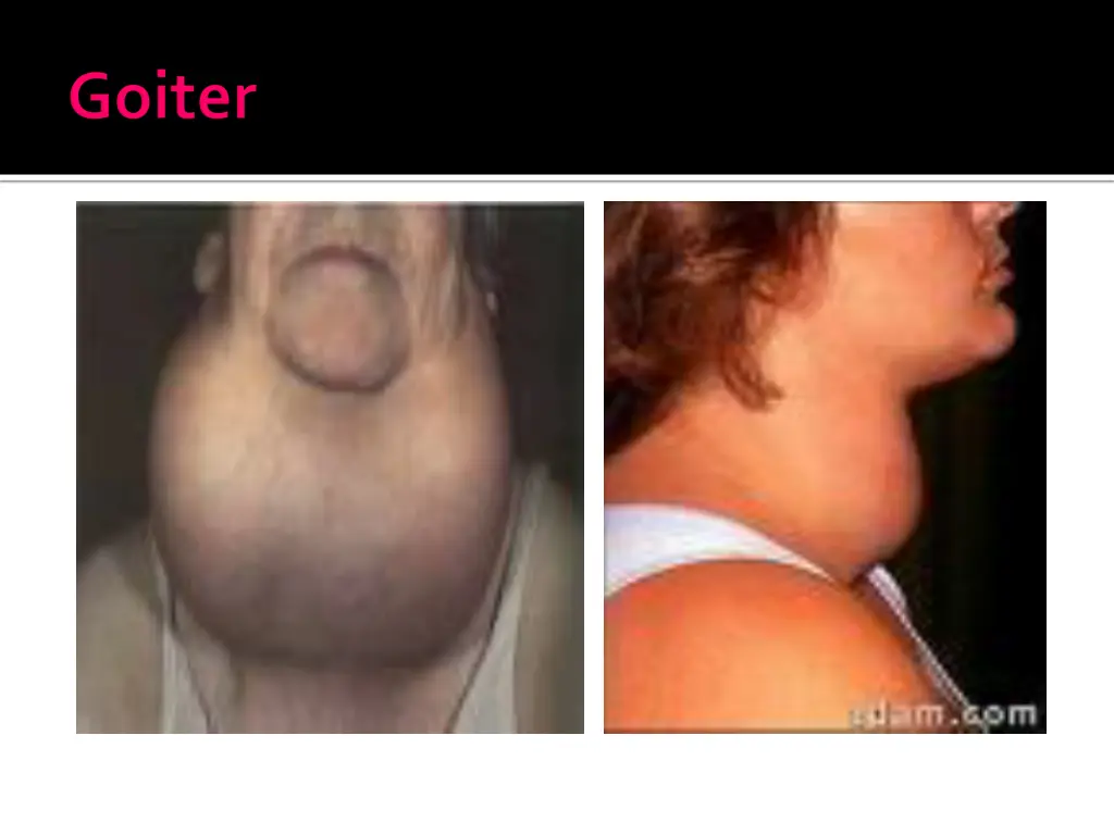 slide26
