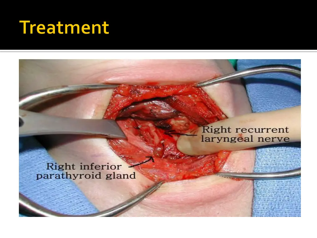 slide30
