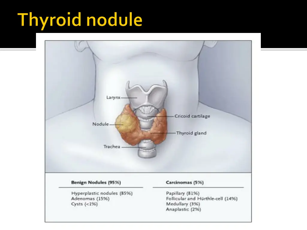 slide33