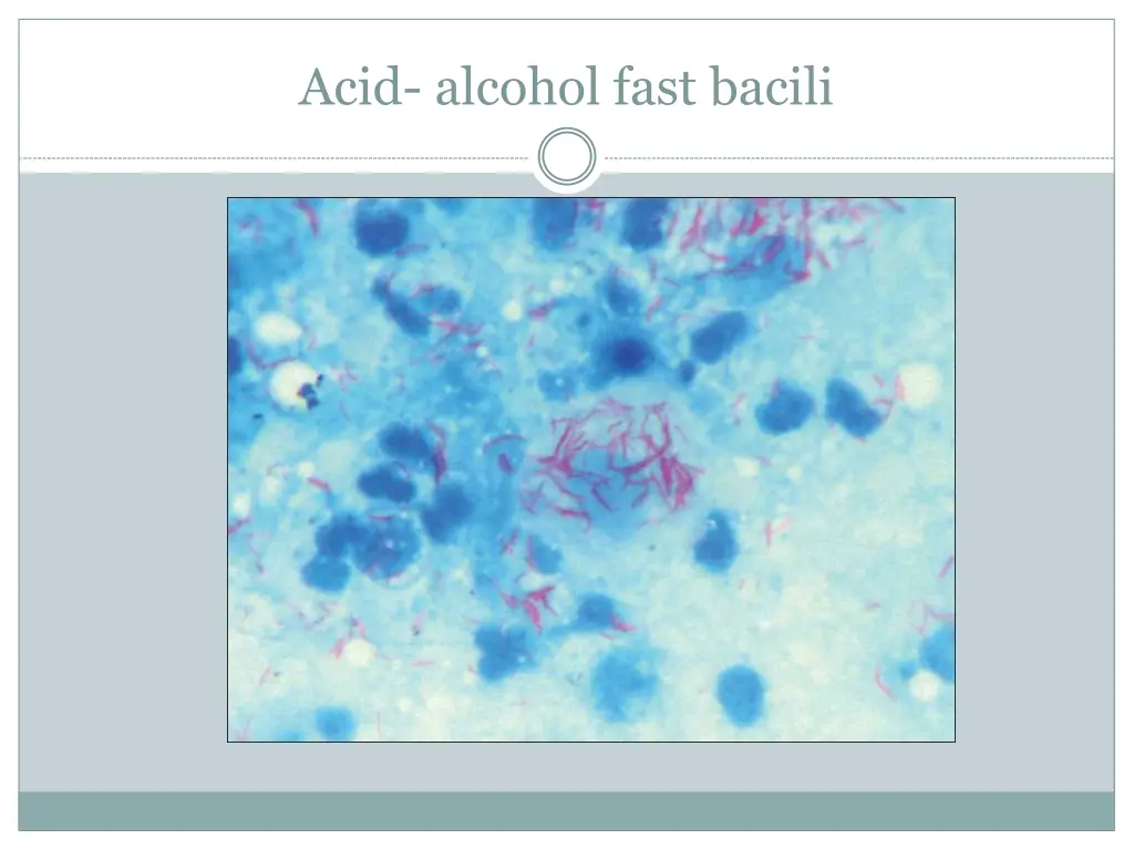 acid alcohol fast bacili