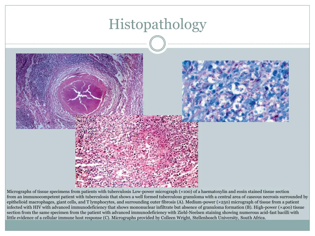 histopathology