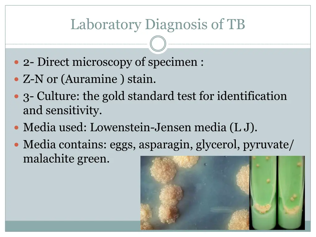 laboratory diagnosis of tb 1