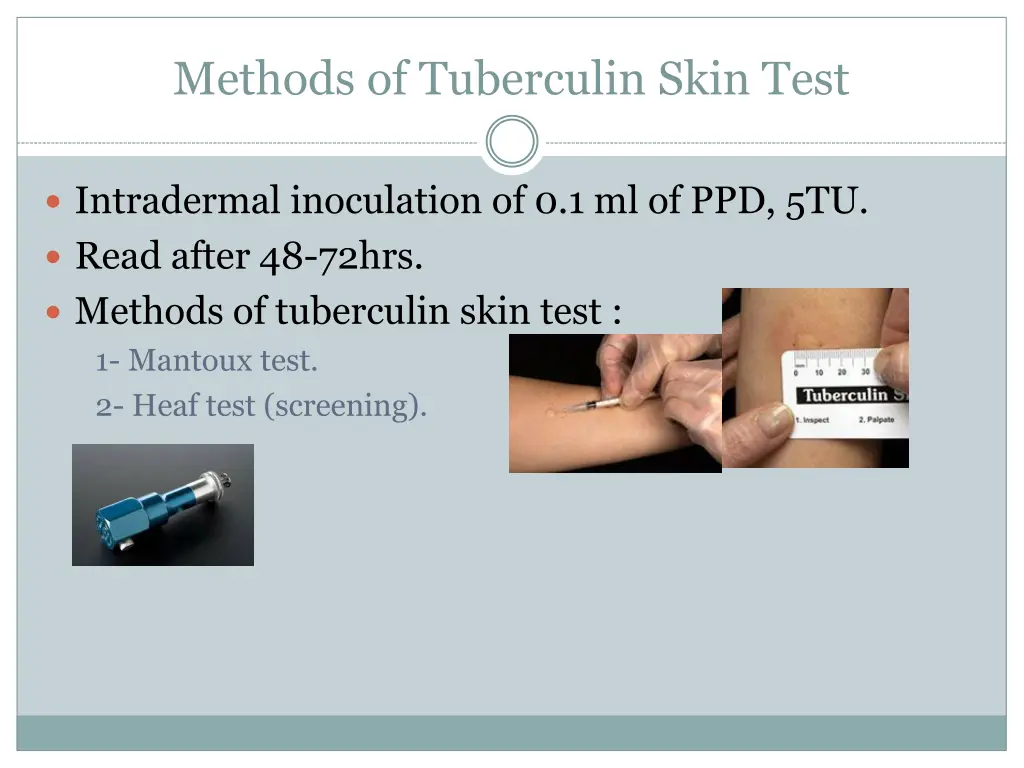 methods of tuberculin skin test