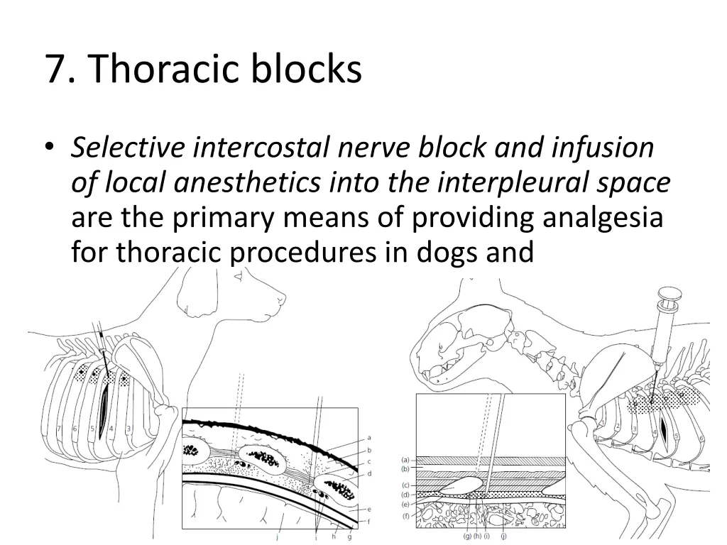 7 thoracic blocks