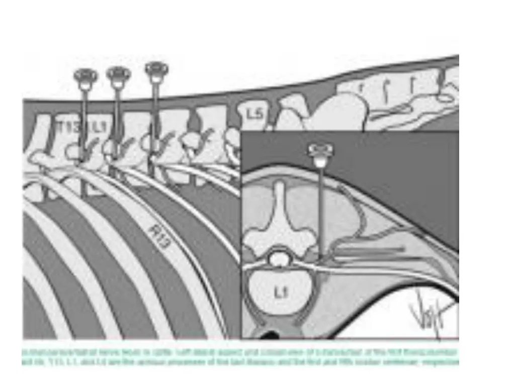slide23