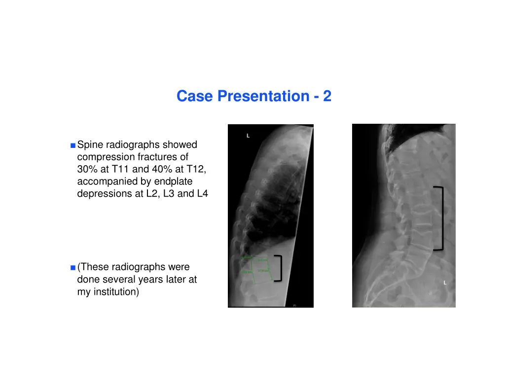 case presentation 2