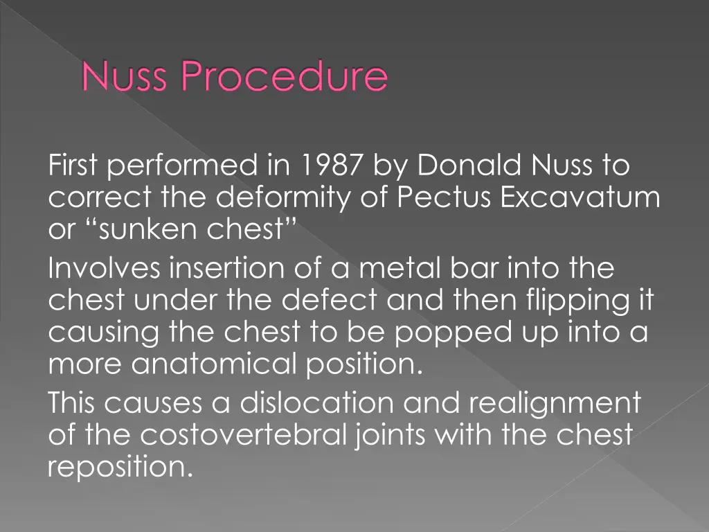 nuss procedure