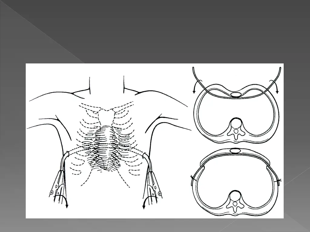 slide13
