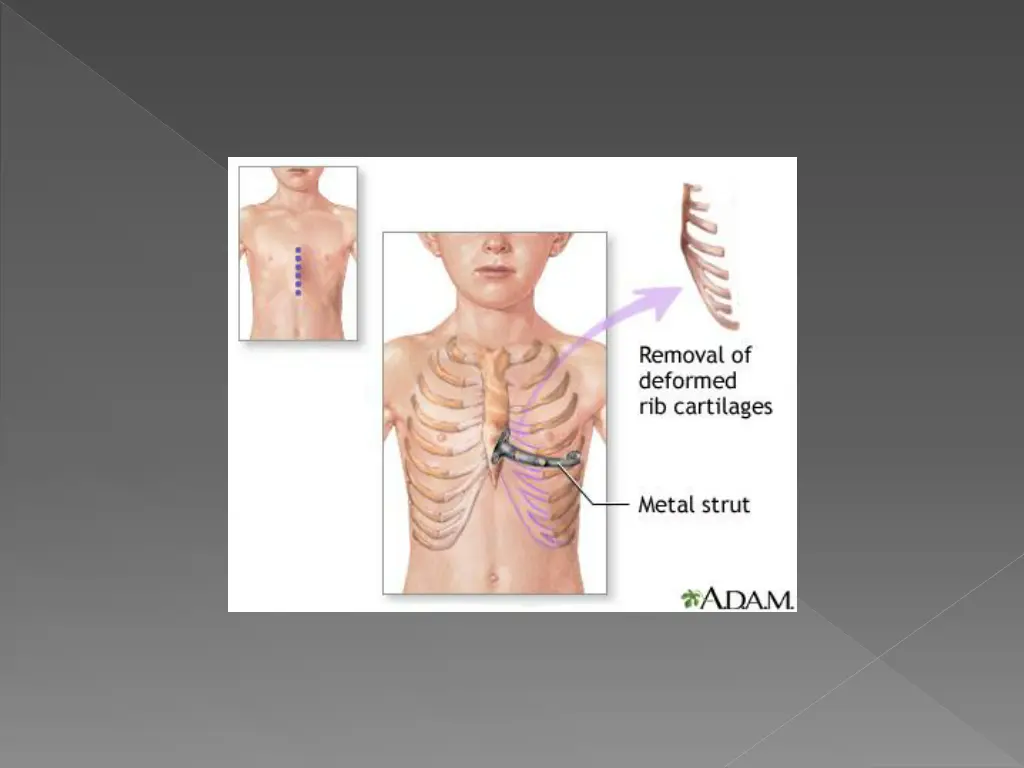 slide15