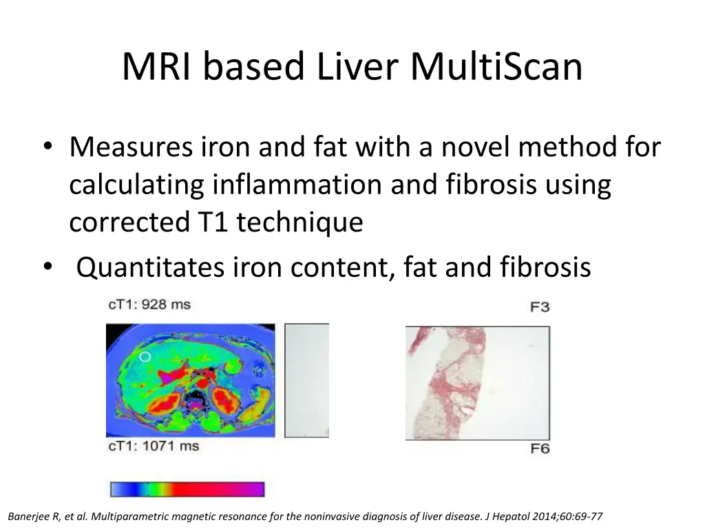 mri based liver multiscan