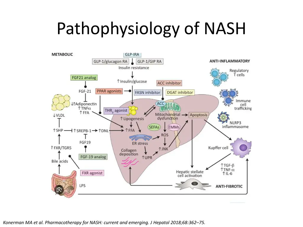 pathophysiology of nash 1