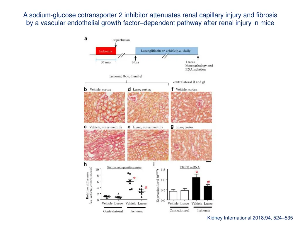 a sodium glucose cotransporter 2 inhibitor