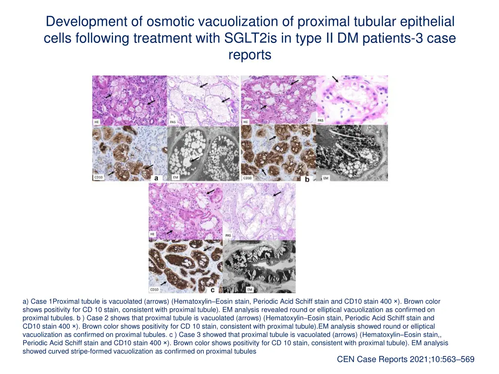 development of osmotic vacuolization of proximal
