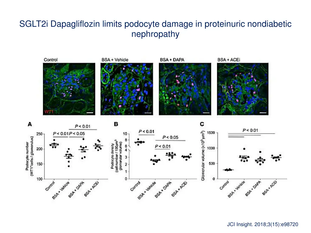 sglt2i dapagliflozin limits podocyte damage