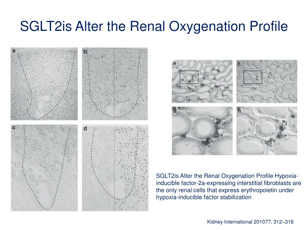 sglt2is alter the renal oxygenation profile