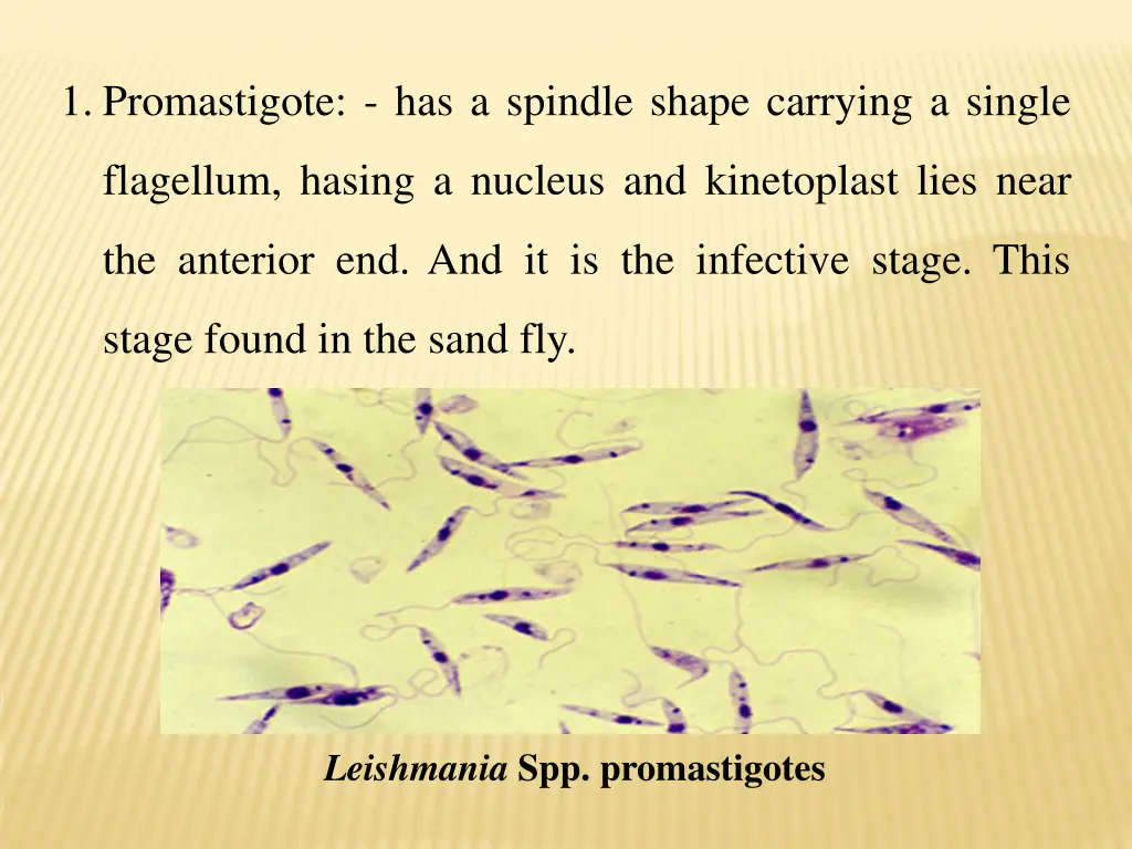 1 promastigote has a spindle shape carrying