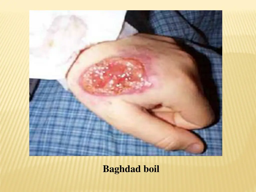 baghdad boil