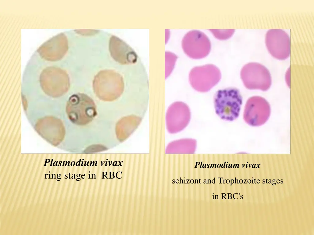 plasmodium vivax ring stage in rbc