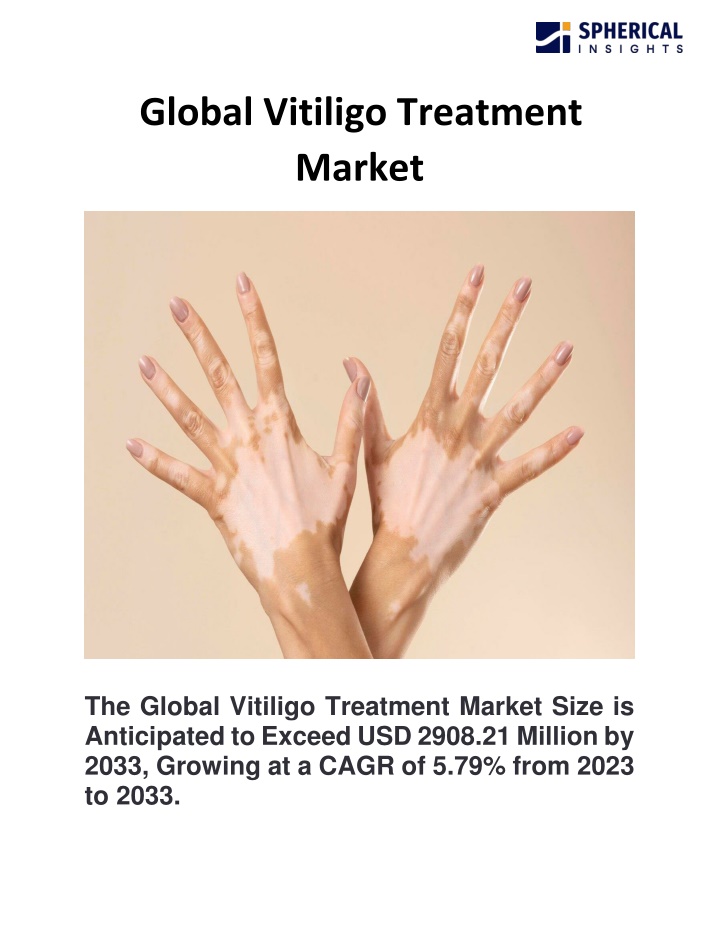 global vitiligo treatment market