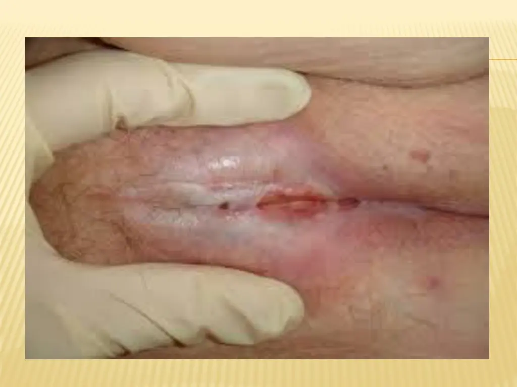 slide17