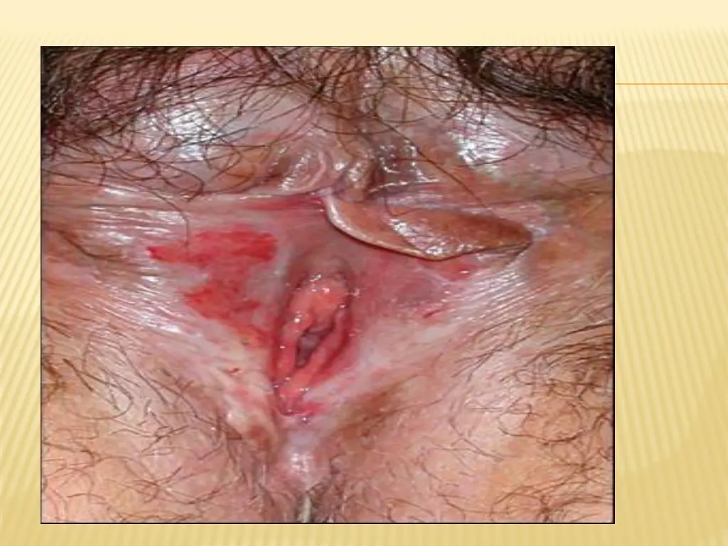 slide20