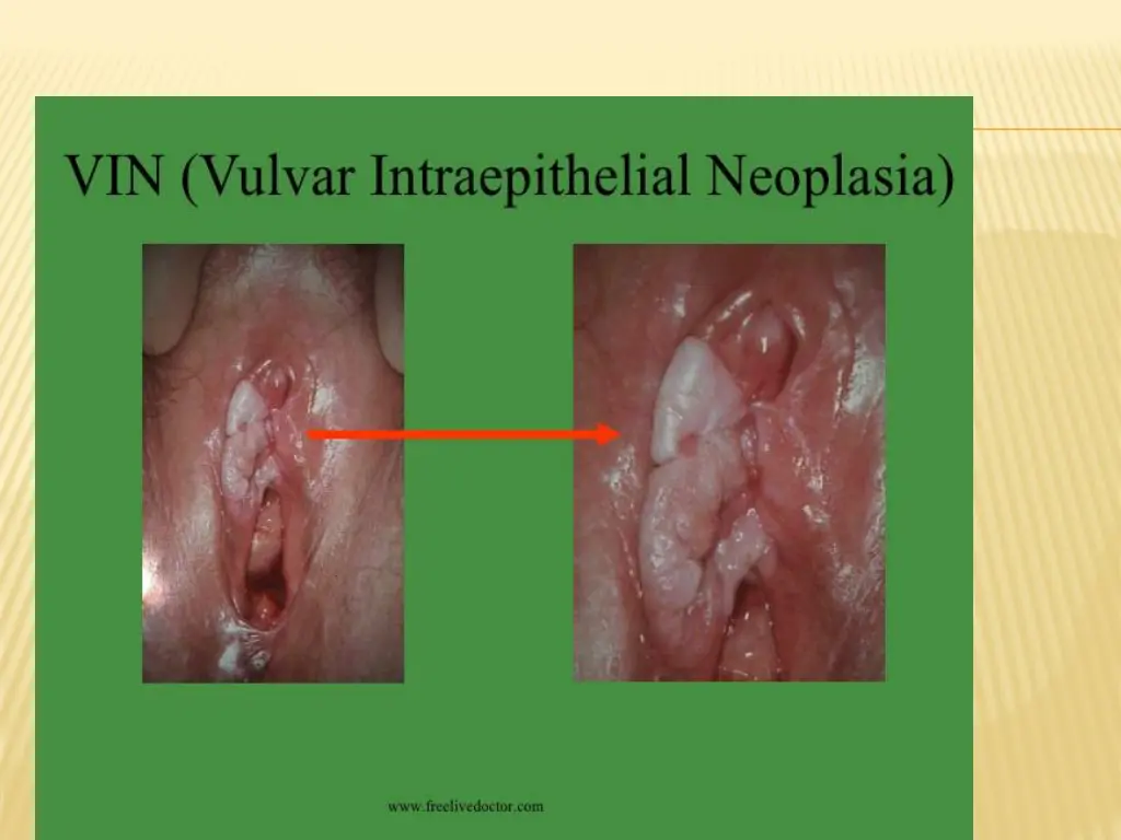 slide30