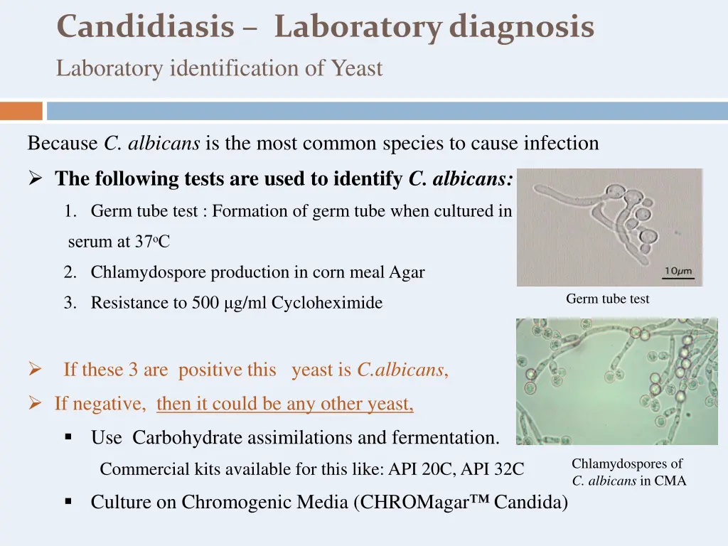 candidiasis laboratory diagnosis laboratory