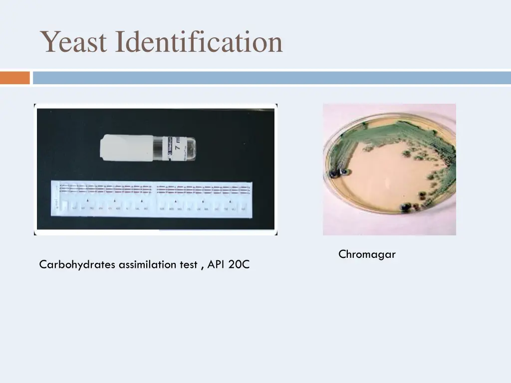 yeast identification