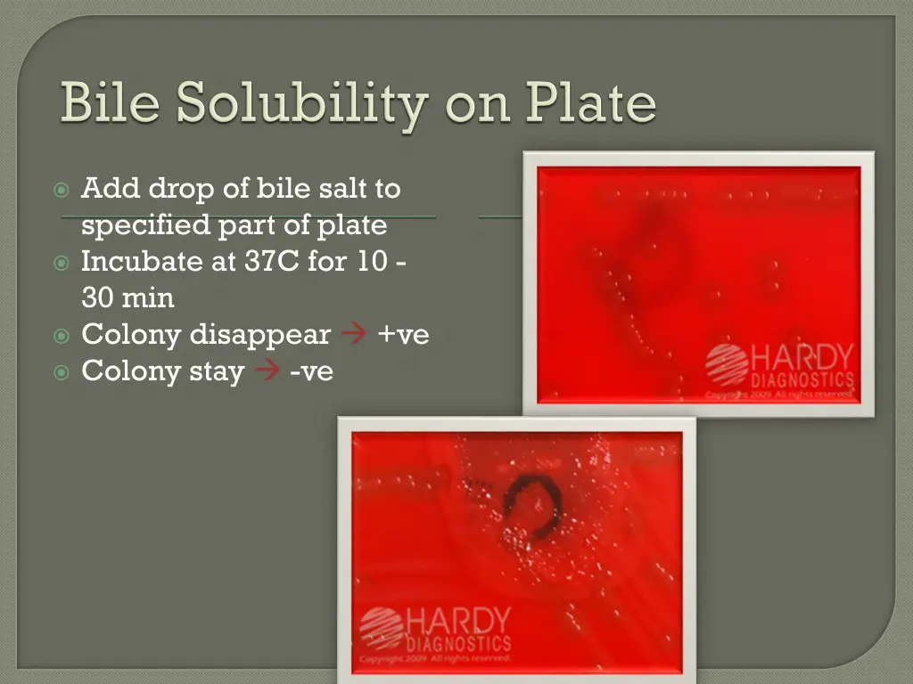 add drop of bile salt to specified part of plate
